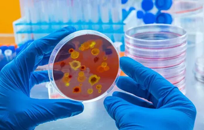 epidemia-ospy?-rumunia-zmaga-sie-z-fala-zakazen