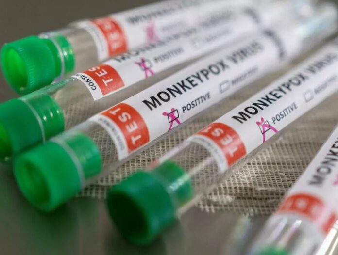 w-niemczech-cztery-osoby-zostaly-zarazone-nowym-szczepem-malpiej-ospy w-niemczech-cztery-osoby-zostaly-zarazone-nowym-szczepem-malpiej-ospy