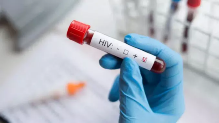 wzrost-zakazen-wirusem-hiv-w-malopolsce